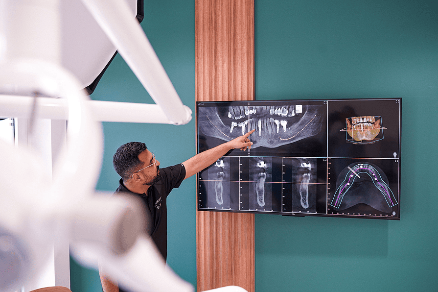 3D-Planung von Zahnimplantaten - Präzisionstechnik in Kerpen
